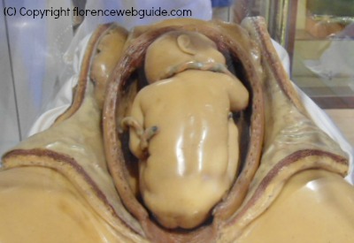 a model to figure out what to do with a breech birth